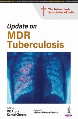 bokomslag Update On Mdr Tuberculosis