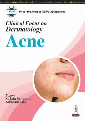 bokomslag Clinical Focus On Dermatology: Acne