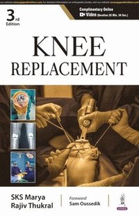 bokomslag Knee Replacement