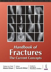 bokomslag Handbook of Fractures