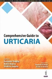 bokomslag Comprehensive Guide To Urticaria