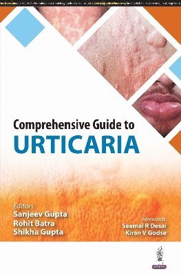 bokomslag Comprehensive Guide To Urticaria