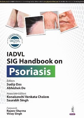 Iadvl Sig Handbook On Psoriasis 1