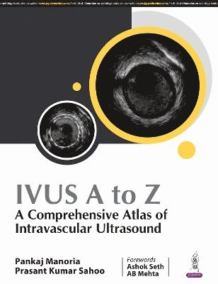 bokomslag Ivus A To Z