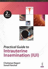 bokomslag Practical Guide to Intrauterine Insemination (IUI)