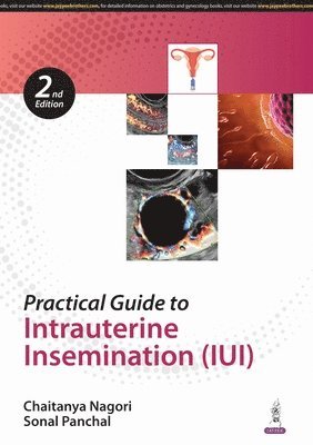 bokomslag Practical Guide To Intrauterine Insemination (Iui)