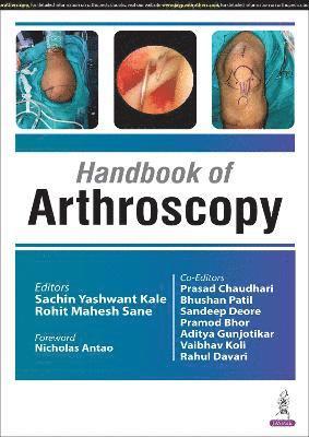 bokomslag Handbook of Arthroscopy
