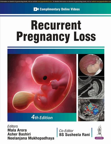 Mala Arora, Asher Bashiri, Neelanjana Mukhopadhaya, BS Susheela Rani - Recurrent Pregnancy Loss, Häftad