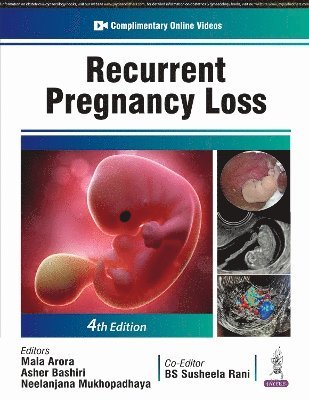 bokomslag Recurrent Pregnancy Loss