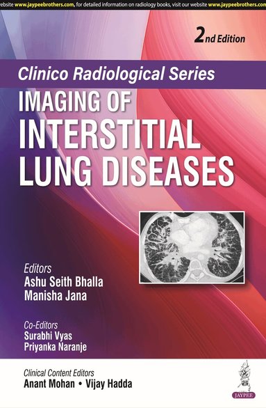Ashu Seith Bhalla, Manisha Jana, Surabhi Vyas, Priyanka Naranje - Clinico Radiological Series: Imaging of Interstitial Lung Diseases, Häftad