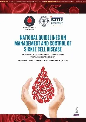 Rabindra Kumar Jena - National Guidelines on Management and Control of Sickle Cell Disease, Häftad. Tillgänglighet: Tillfälligt slut