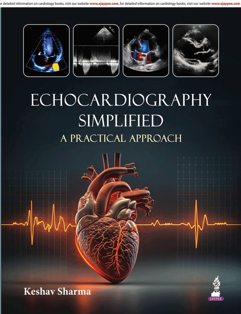 Keshav Sharma - Echocardiography Simplified, Häftad