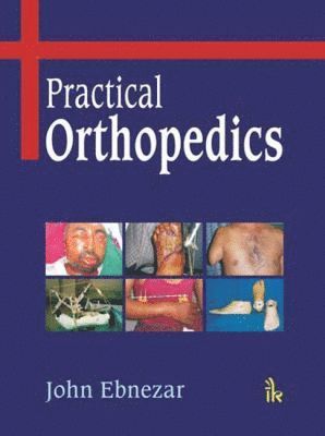 John Ebnezar - Practical Orthopedics, Inbunden