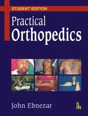 John Ebnezar - Practical Orthopedics, Häftad