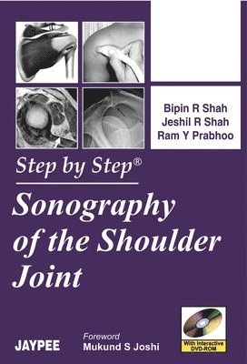 Step By Step Sonography of the Shoulder Joint 1