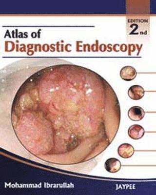 Atlas of Diagnostic Endoscopy 1