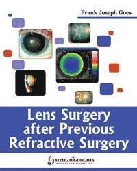 bokomslag Lens Surgery After Previous Refractive Surgery