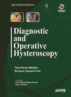 Diagnostic and Operative Hysteroscopy 1