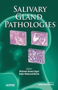 bokomslag Salivary Gland Pathologies