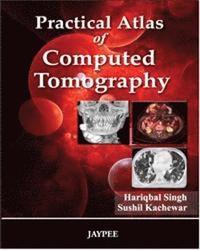 bokomslag Practical Atlas of Computed Tomography