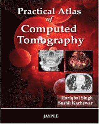 Practical Atlas of Computed Tomography 1