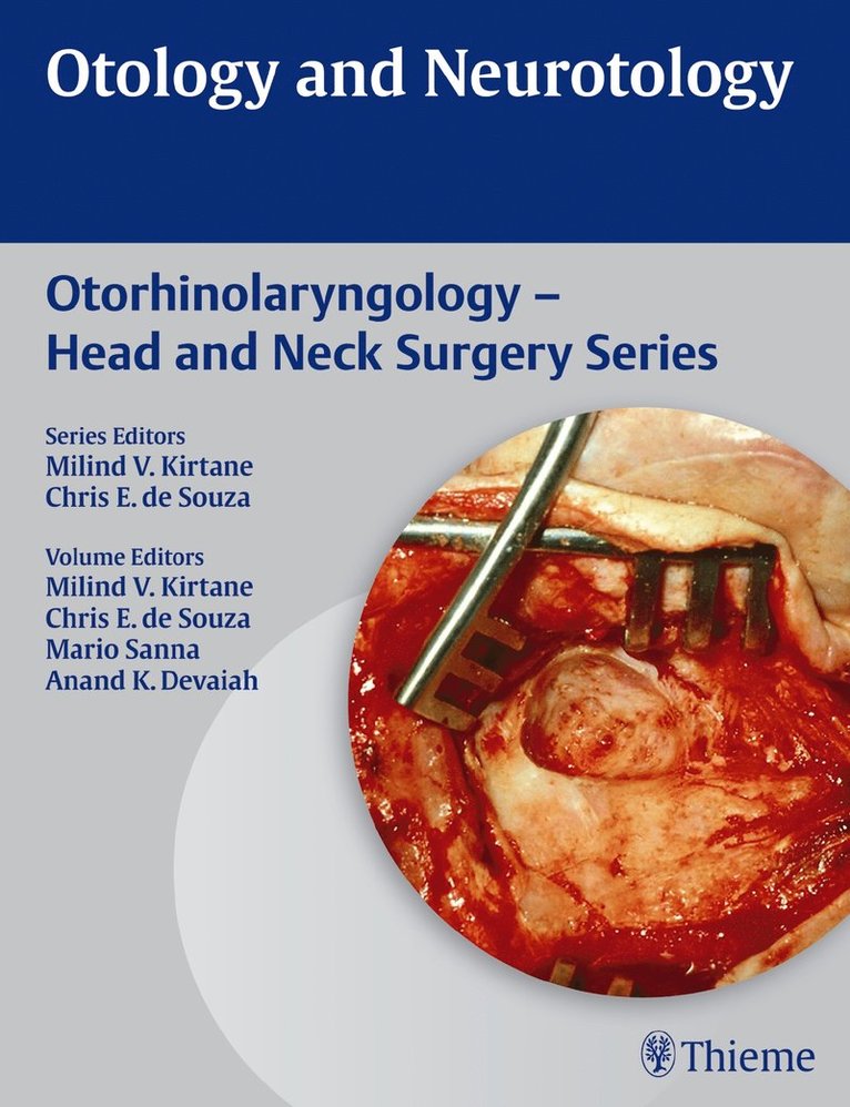 Mario Sanna, Anand K. Devaiah, Anand K Devaiah, Milind V Kirtane, Chris E de Souza - Otology and Neurotology, Inbunden
