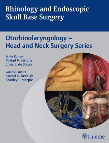 Anand K. Devaiah, Bradley F. Marple, Anand K Devaiah, Bradley F Marple - Rhinology and Endoscopic Skull Base Surgery, Inbunden