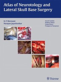 bokomslag Atlas of Neurotology and Lateral Skull Base Surgery