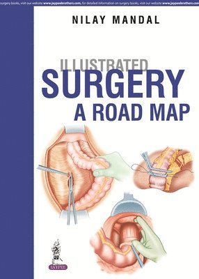 Nilay Mandal - Illustrated Surgery - A Road Map, Inbunden