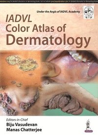 bokomslag IADVL Color Atlas of Dermatology