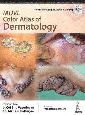 bokomslag IADVL Color Atlas of Dermatology