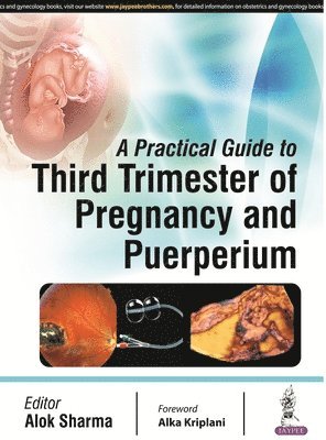 A Practical Guide to Third Trimester of Pregnancy & Puerperium 1