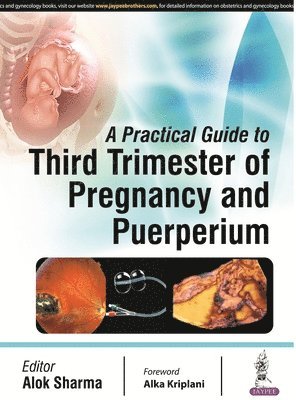 Alok Sharma - Practical Guide to Third Trimester of Pregnancy & Puerperium, Häftad