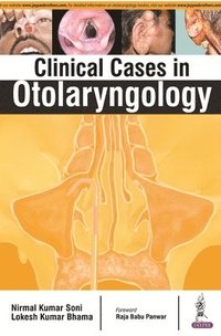 bokomslag Clinical Cases in Otolaryngology