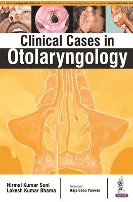 bokomslag Clinical Cases in Otolaryngology