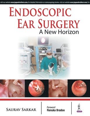 Endoscopic Ear Surgery 1