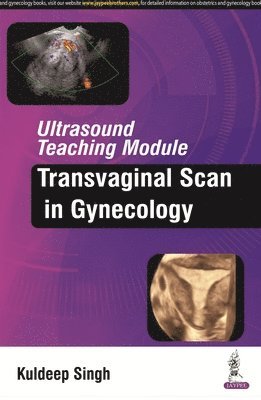 Kuldeep Singh - Ultrasound Teaching Module: Transvaginal Scan in Gynecology, Häftad