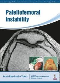 bokomslag Patellofemoral Instability