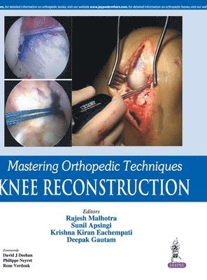 bokomslag Mastering Orthopedic Techniques: Knee Reconstruction