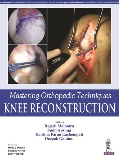 bokomslag Mastering Orthopedic Techniques: Knee Reconstruction