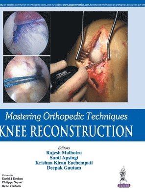 Rajesh Malhotra, Sunil Apsingi, Krishna Kiran Eachempati, Deepak Gautam - Mastering Orthopedic Techniques: Knee Reconstruction, Inbunden