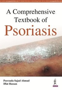 bokomslag A Comprehensive Textbook of Psoriasis