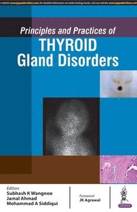 bokomslag Principles and Practices of Thyroid Gland Disorders