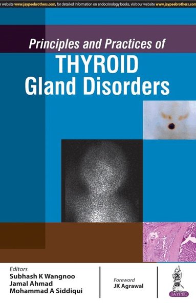 Subhash Kumar Wangnoo, Jamal Ahmad, Mohammad Asim Siddiqui - Principles and Practices of Thyroid Gland Disorders, Inbunden