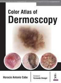 bokomslag Color Atlas of Dermoscopy