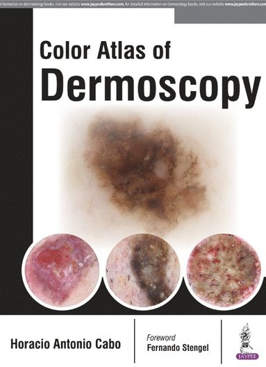 bokomslag Color Atlas of Dermoscopy