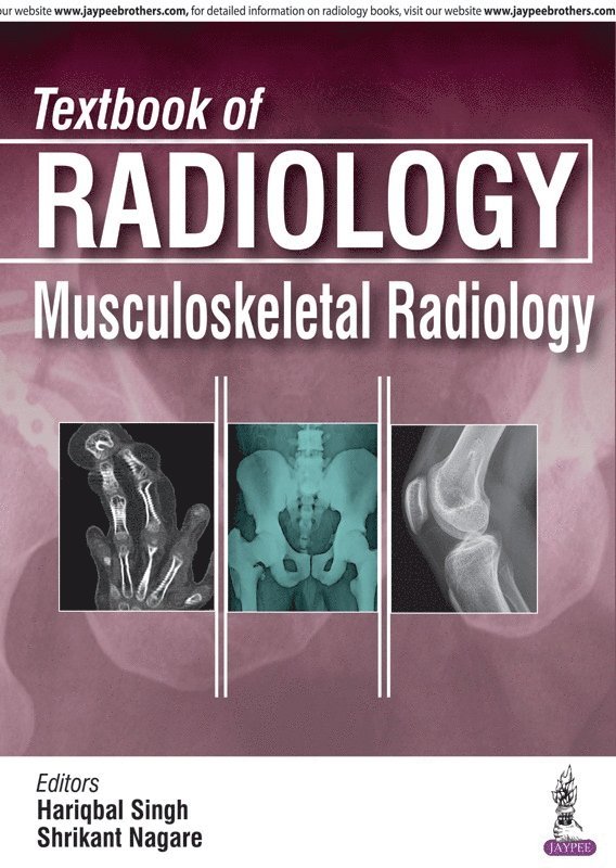 Hariqbal Singh - Textbook of Radiology: Musculoskeletal Radiology, Häftad