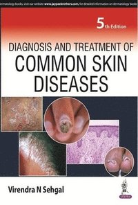 bokomslag Diagnosis and Treatment of Common Skin Diseases