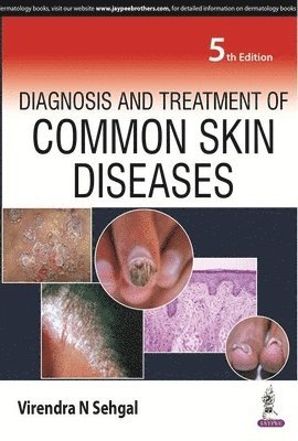 Diagnosis and Treatment of Common Skin Diseases 1