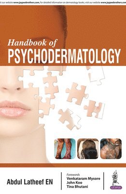 Handbook of Psychodermatology 1